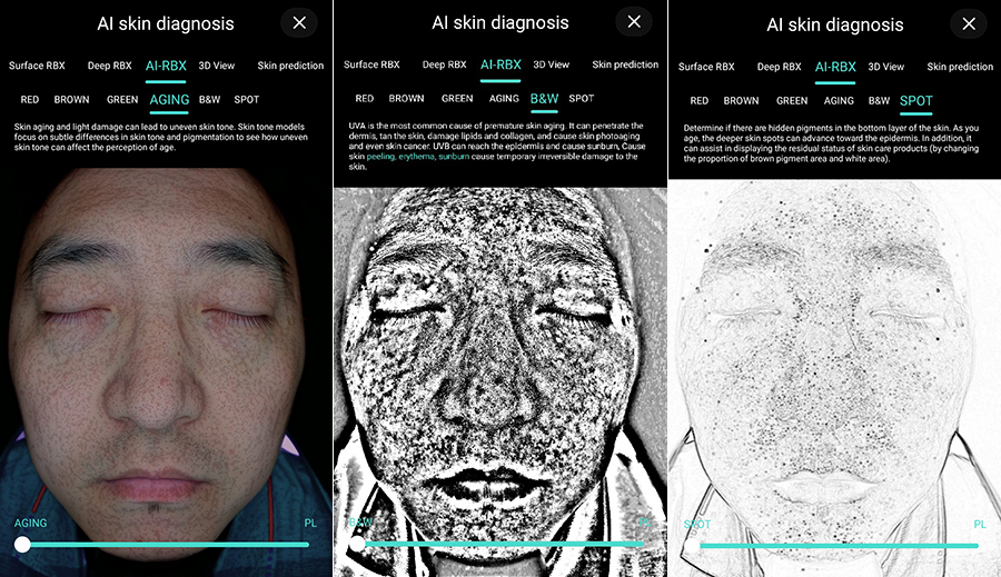 Waarom steeds meer esthetische centra Skin Analyzer gebruiken?